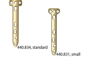 TomoFix Medial High Tibia