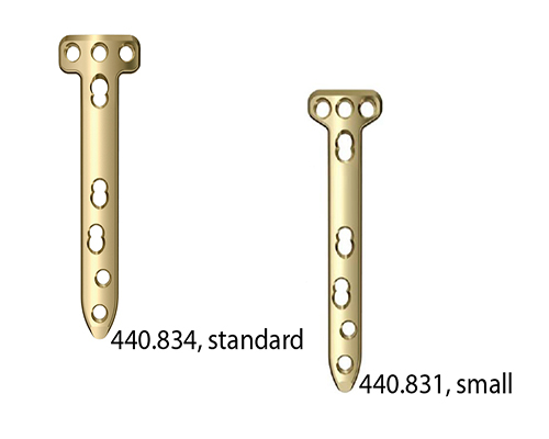 TomoFix Medial High Tibia